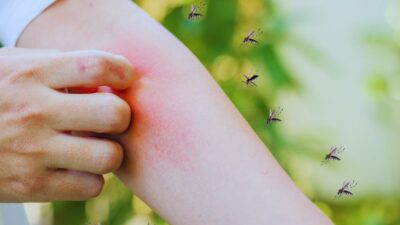 Chikungunya spike in China
